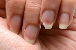 Unhas frágeis de mais
